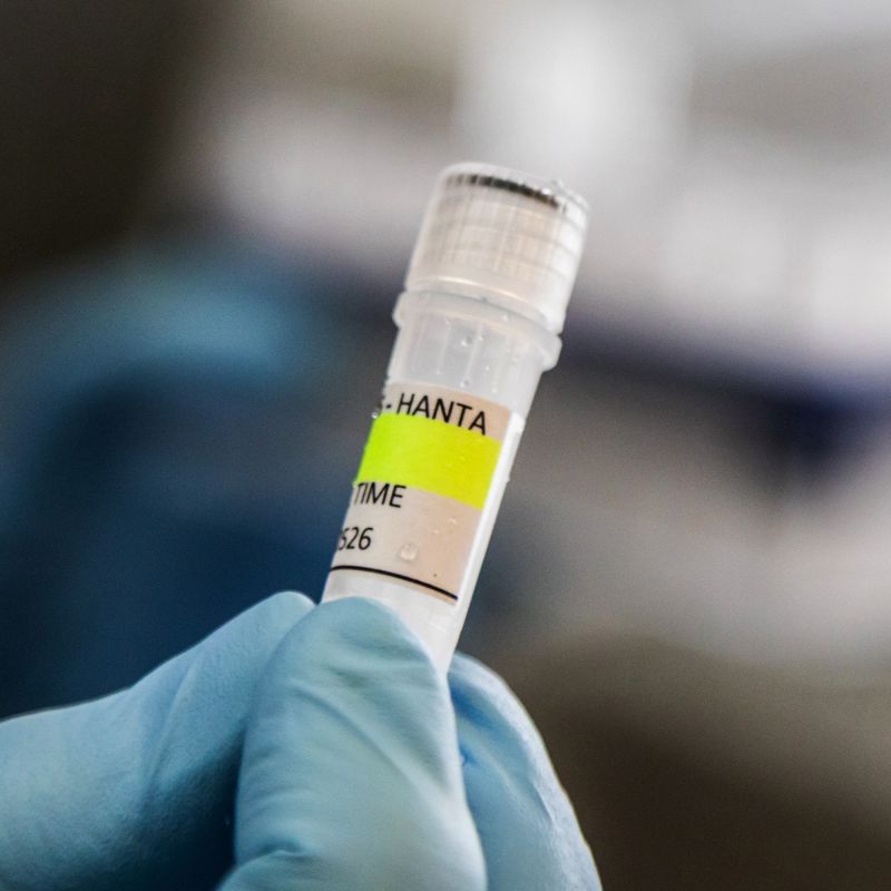 Hantavirus : des assurances du gouvernement face à la situation