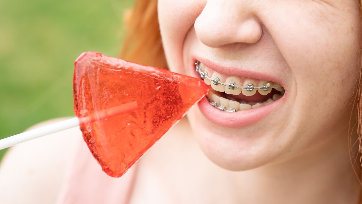 Découvrez comment votre alimentation influence votre sourire
